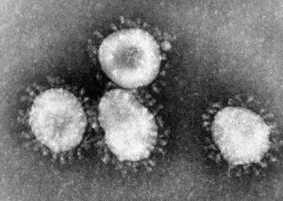 Коронавирусы под электронным микроскопом. Фото: CDC / Dr. Fred Murphy / Wikipediа
