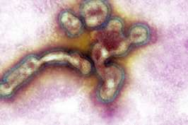 Вирусу птичьего гриппа стало легче размножаться в организме человека