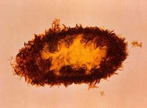 Ещё один необычный микроорганизм — бактерия Desulphovibrio sp. bacterium, поедающая серосодержащие токсические соединения (фото Jim Watson / University of Southampton).