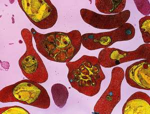Эритроциты с возбудителем малярии внутри. Фото: http://science.compulenta.ru