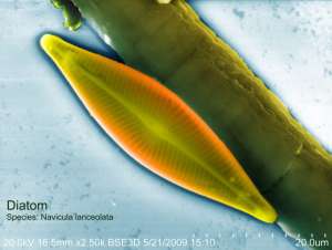 Диатомовая водоросль (сканирующая электронная микрофотография SemPhotos).